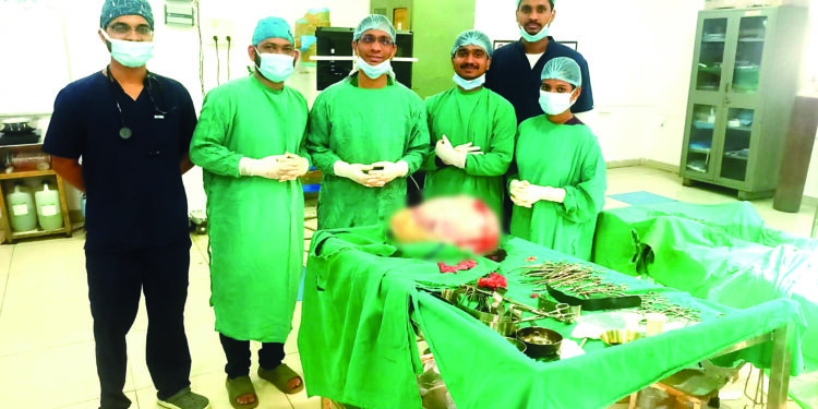 बापरे पोटातून निघाला बारा किलोंचा गोळा